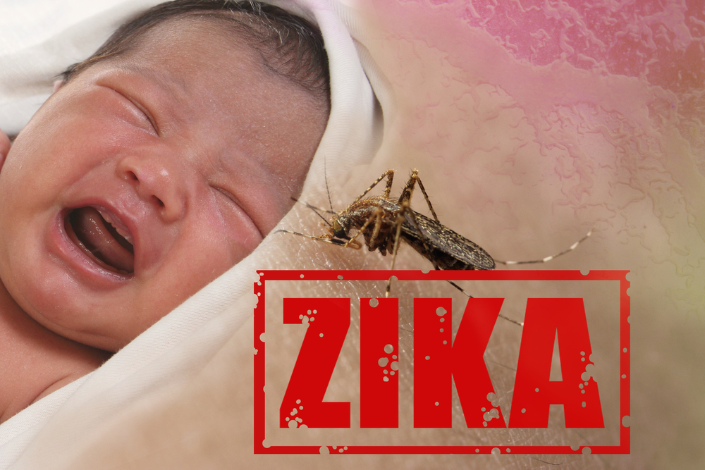 Zika Virus (Shutterstock)