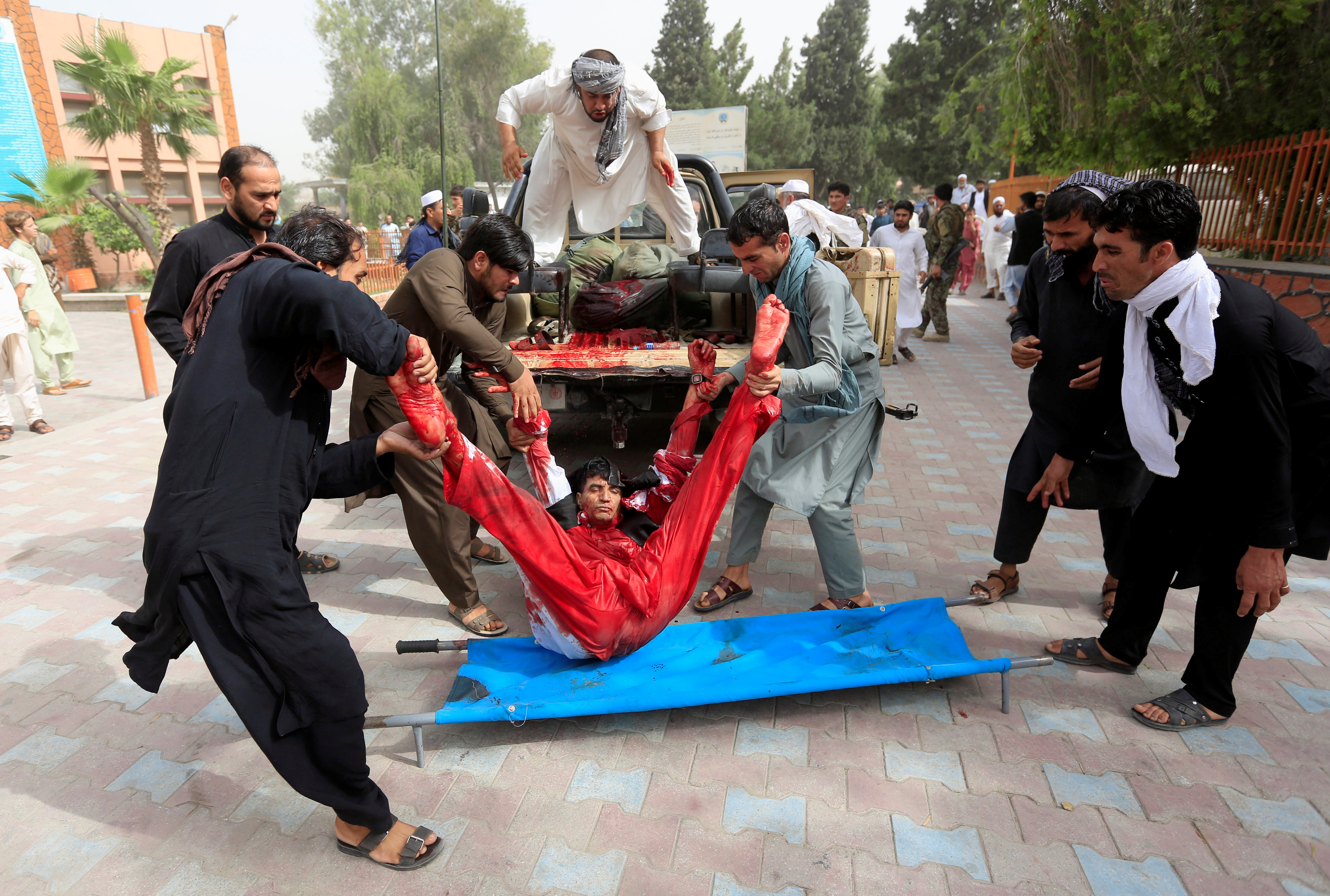 An injured man is moved to a stretcher to be brought to a hospital after a car bomb in Jalalabad city, Afghanistan June 17, 2018. REUTERS/Parwiz 